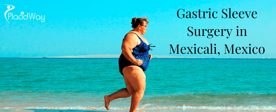 Gastric Sleeve Surgery in Mexicali, Mexico