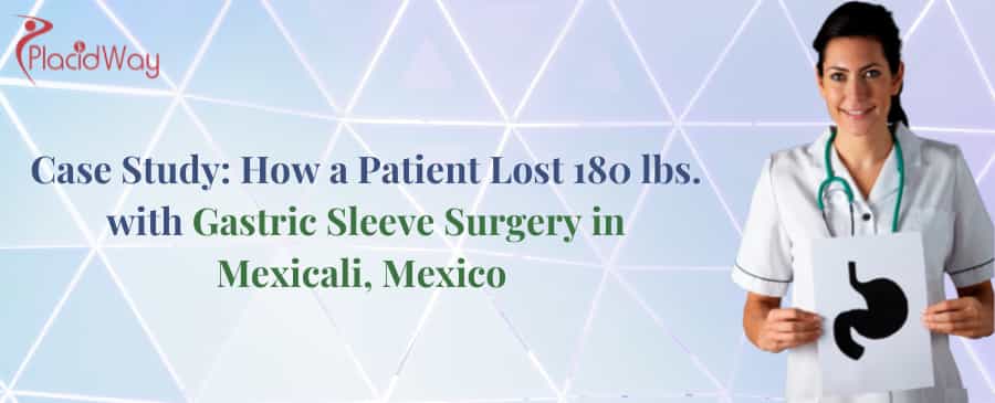 Gastric Sleeve Surgery in Mexicali, Mexico PlacidWay Case Study