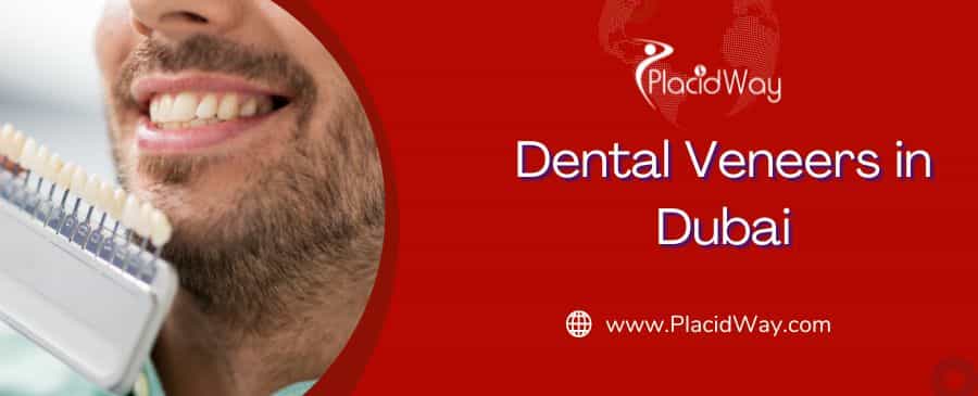  Dental Veneers Price in Dubai, UAE