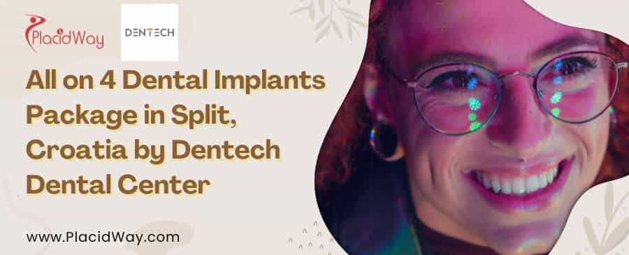 All on 4 Dental Implants Package in Split, Croata by Dentech