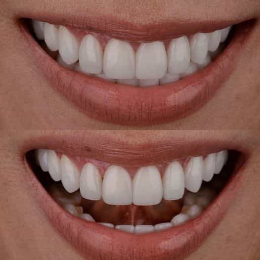 Dr Somkiat Before After