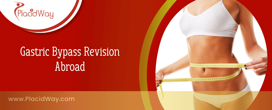Gastric Bypass Revision Abroad