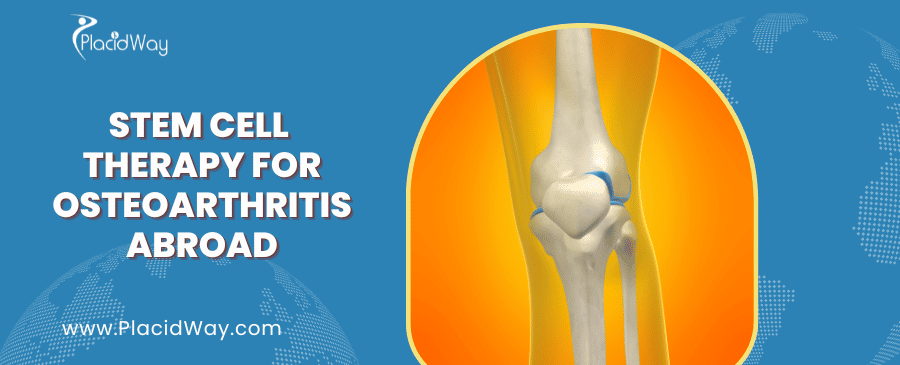 Stem Cell Therapy for Osteoarthritis Abroad