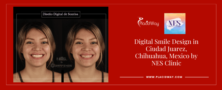 Before and After Digital Smile Design by NES Clinic in Juarez, Mexio