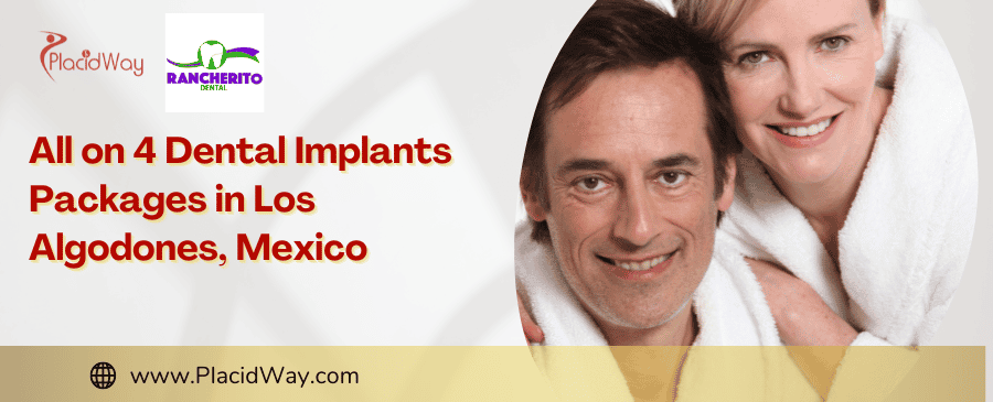 All on 4 Dental Implants Packages in Los Algodones, Mexico