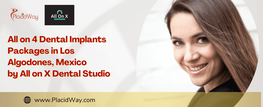 All on 4 Dental Implants Packages in Los Algodones, Mexico