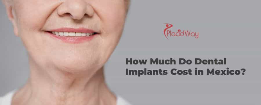 How Much Do Dental Implants Cost in Mexico?
