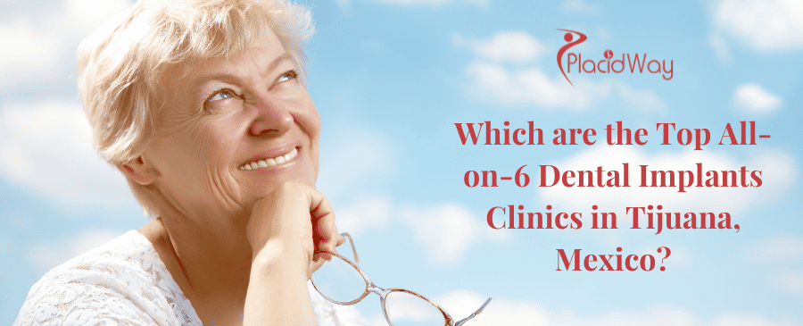 Which are the Top All-on-6 Dental Implants Clinics in Tijuana, Mexico