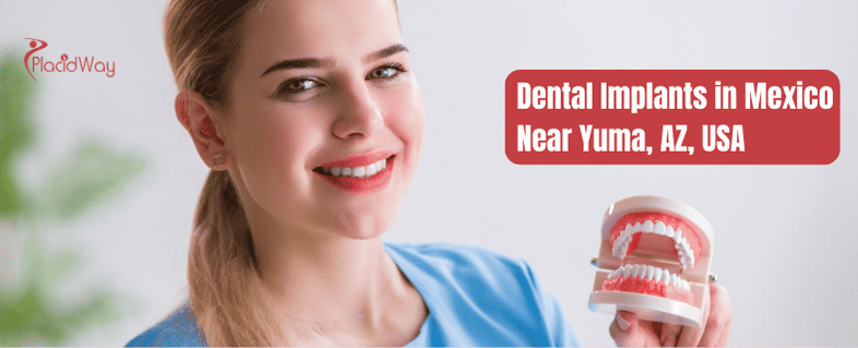 Dental Implants in Mexico Near Yuma, AZ, USA