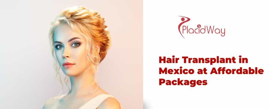 Hair Transplant in Mexico