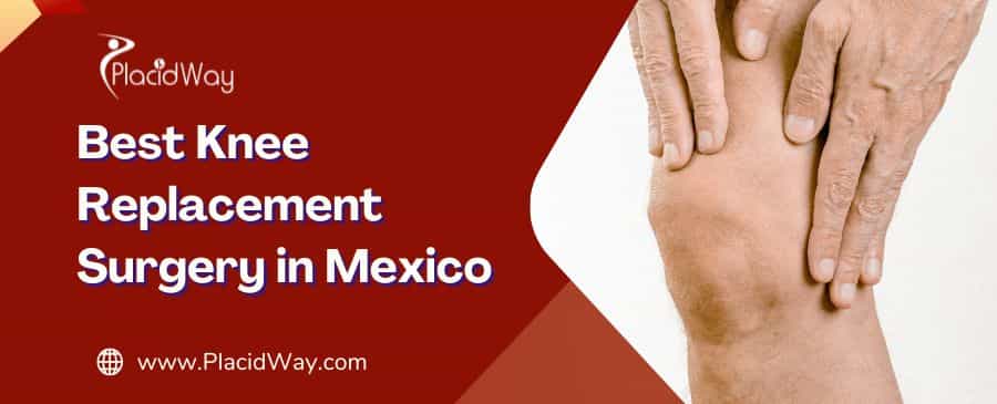 knee replacement surgery in Mexico