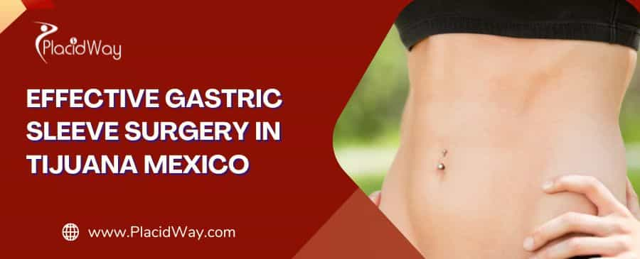 Gastric Sleeve Surgery in Tijuana Mexico