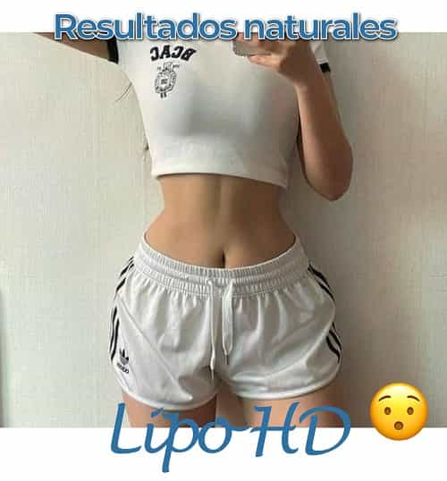 Medina Flores - Imagen de antes y después de liposucción