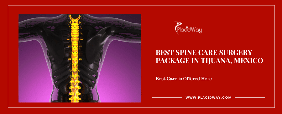 Best Spine Care Surgery Package in Tijuana, Mexico