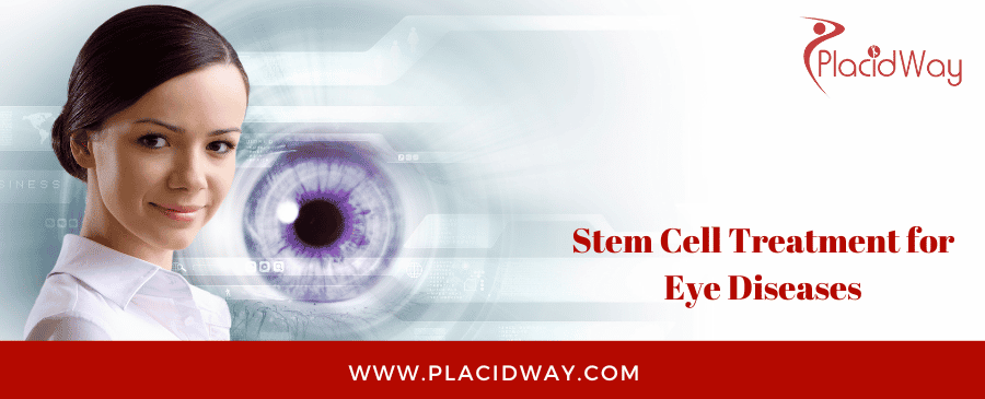 Stem Cell Treatment for Eye Diseases