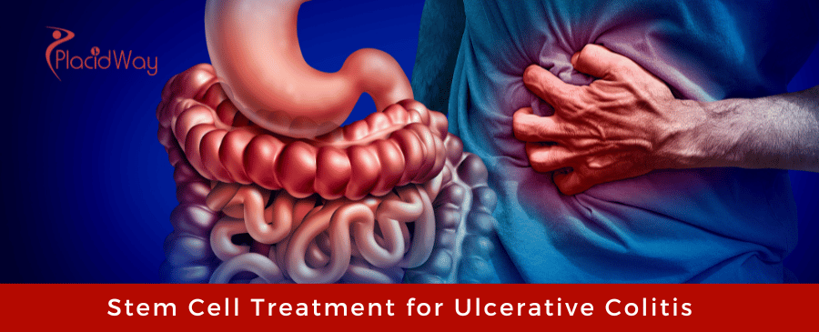 Stem Cell Treatment for Ulcerative Colitis