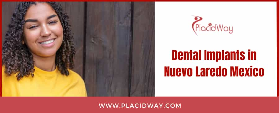 Dental Implants in Nuevo Laredo Mexico