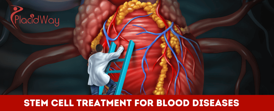 Stem Cell Treatment for Blood Diseases