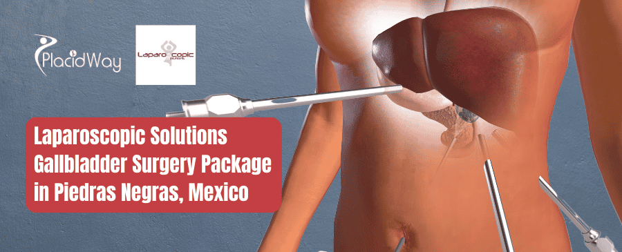 Laparoscopic Solutions Gallbladder Surgery Package in Piedras Negras, Mexico