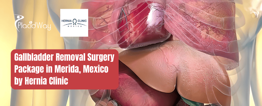 Gallbladder Removal Surgery Package in Merida, Mexico by Hernia Clinic
