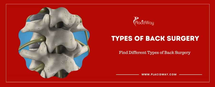 Types of Back Surgery