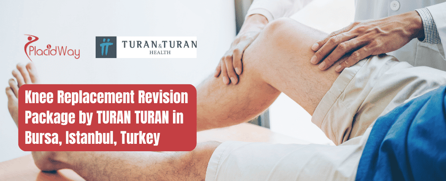 Knee Replacement Revision Package by TURAN TURAN in Bursa, Istanbul, Turkey