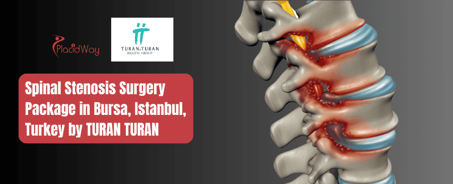 Spinal Stenosis Surgery Package in Bursa, Istanbul, Turkey by TURAN TURAN