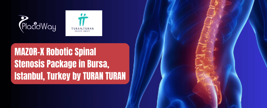 MAZOR-X Robotic Spinal Stenosis Package in Bursa, Istanbul, Turkey by TURAN TURAN