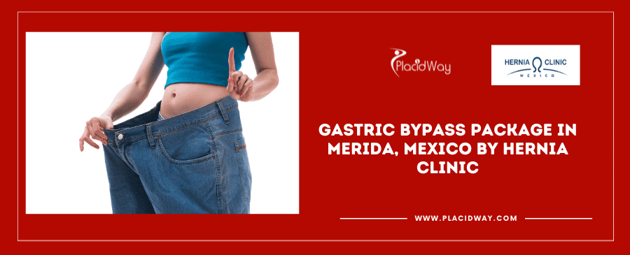 Gastric Bypass in Merida, at Hernia Clinic Mexico at Awesome Cost
