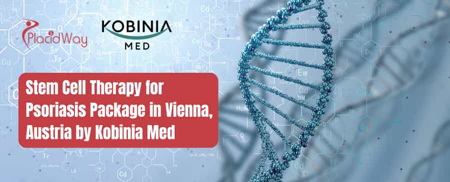 Stem Cell Therapy for Psoriasis Package in Vienna, Austria Kobinia Med