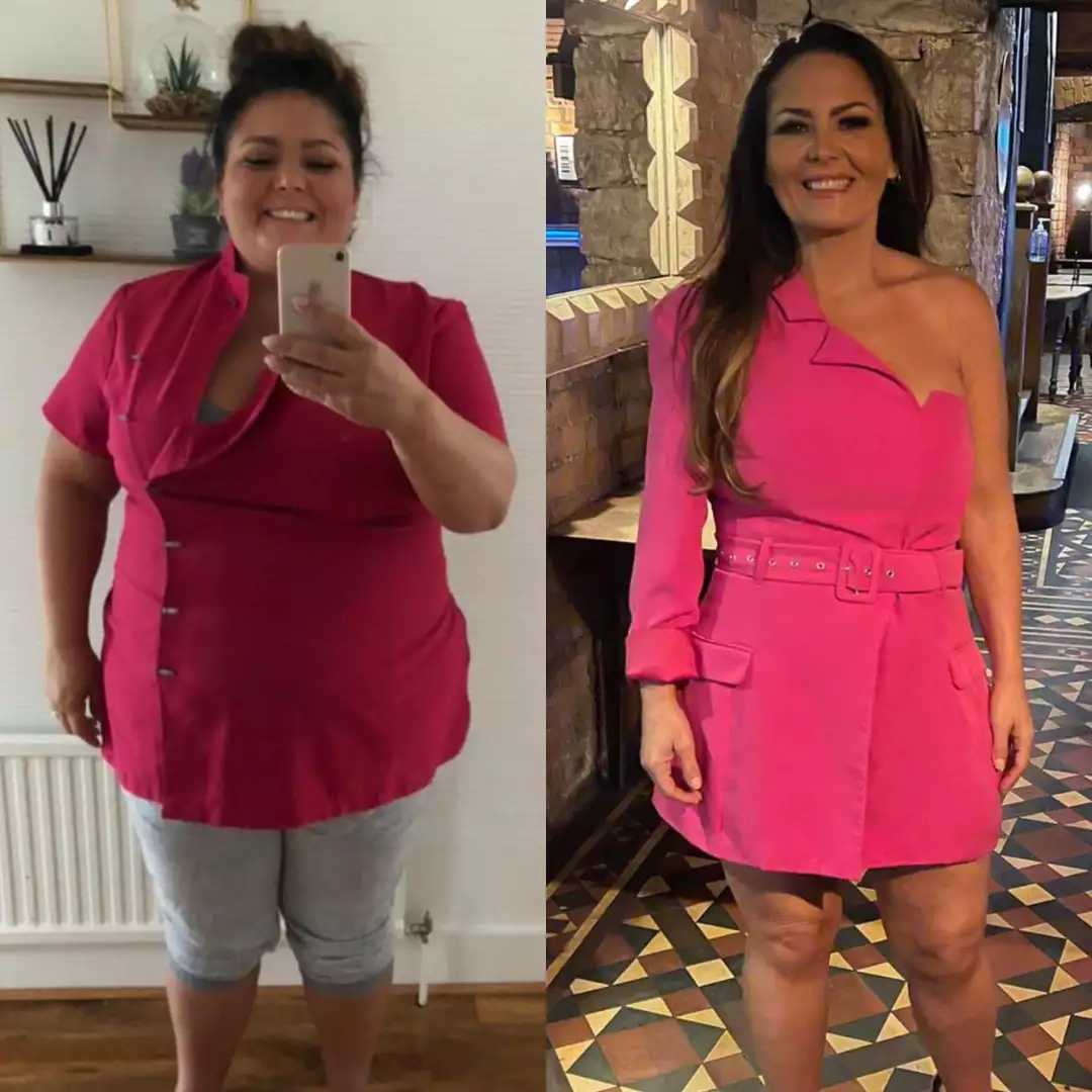 Weight Loss Surgery In Turkey