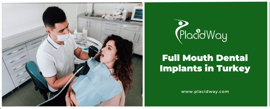 Full Mouth Dental Implants Turkey Package Deals