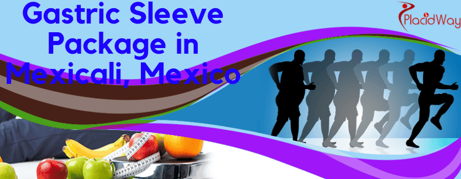Gastric Sleeve Surgery in Mexicali Mexico 