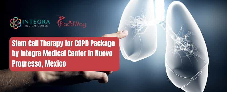 Stem Cell Therapy for COPD Package by Integra Medical Center in Nuevo Progreso, Mexico