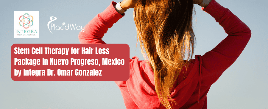 Stem Cell Therapy for Hair Loss Package in Nuevo Progreso, Mexico by Integra Dr. Omar Gonzalez