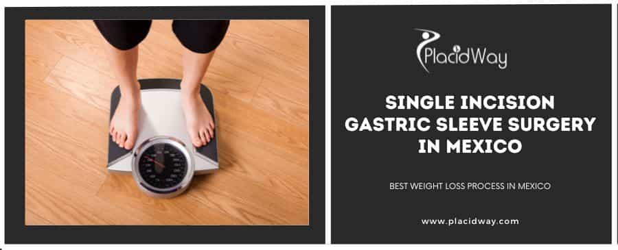 Single Incision Gastric Sleeve Surgery In Mexico