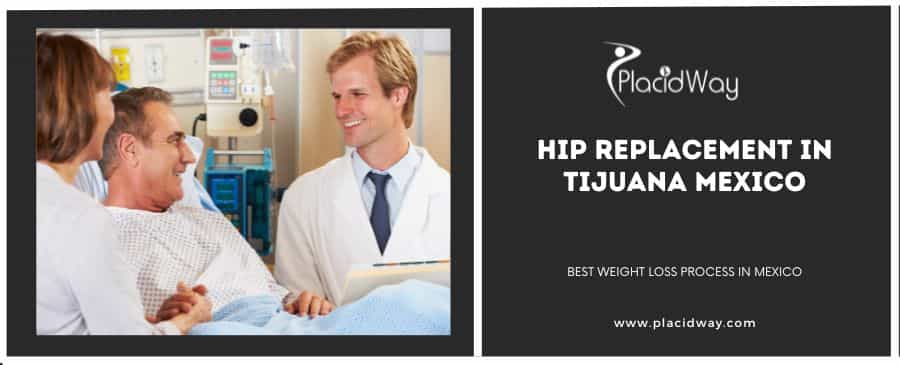 Hip Replacement in Tijuana, Mexico