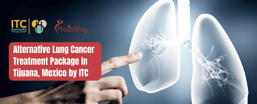 Alternative Lung Cancer Treatment Package in Tijuana, Mexico by ITC