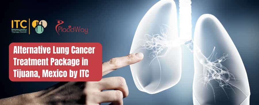 Paquete de tratamiento alternativo para el cáncer de pulmón en Tijuana, México, ofrecido por ITC