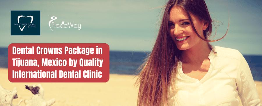 Paquete de coronas dentales en Tijuana, México por Quality International Dental Clinic