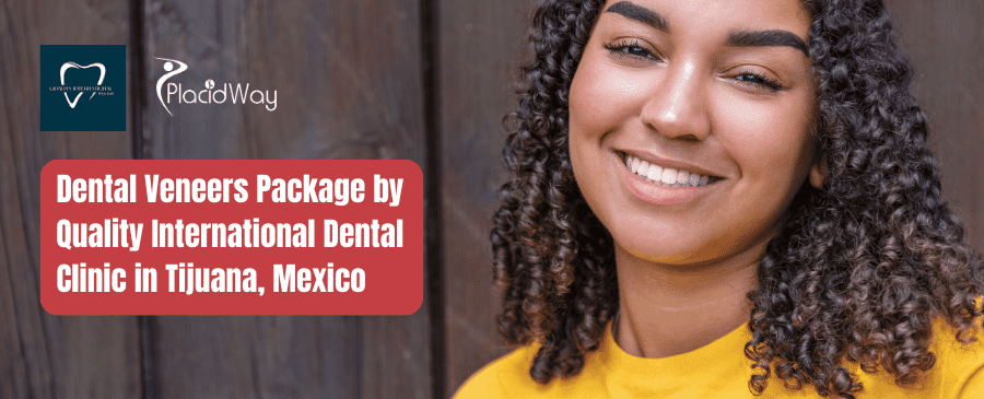 Dental Veneers Package by Quality International Dental Clinic in Tijuana, Mexico