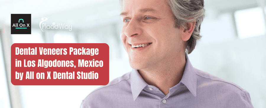 Dental Veneers Package in Los Algodones, Mexico by All on X Dental Studio
