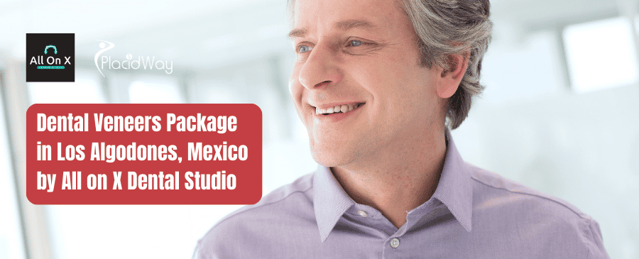 Paquete de carillas dentales en Los Algodones, México por All on X Dental Studio