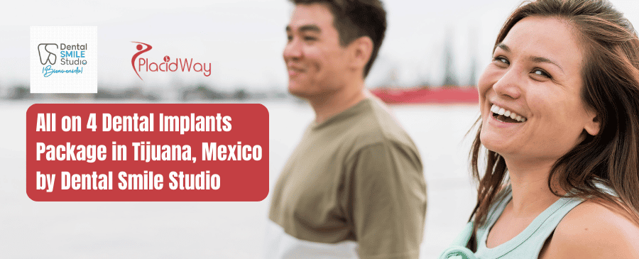 All on 4 Dental Implants Package in Tijuana, Mexico by Dental Smile Studio
