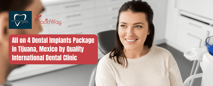 All on 4 Dental Implants Package in Tijuana, Mexico by Quality International Dental Clinic