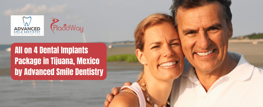 All on 4 Dental Implants Package in Tijuana, Mexico by Advanced Smile Dentistry