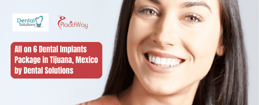 All on 6 Dental Implants Package in Tijuana, Mexico by Dental Solutions