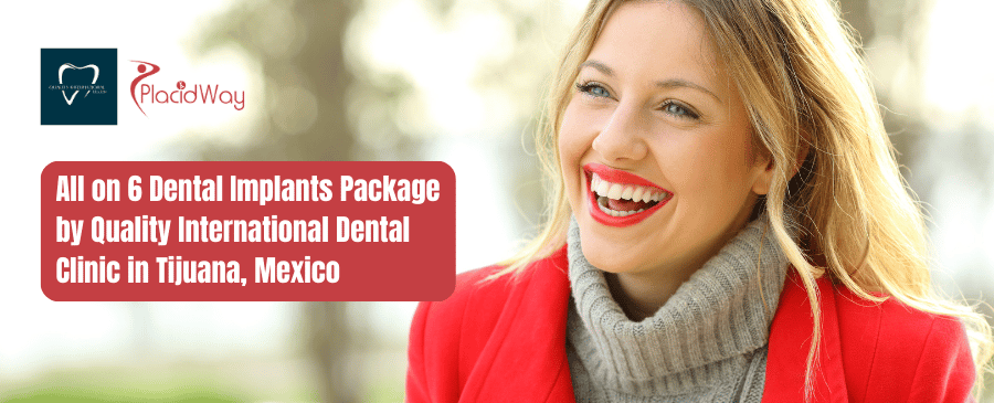 All on 6 Dental Implants Package by Quality International Dental Clinic in Tijuana, Mexico
