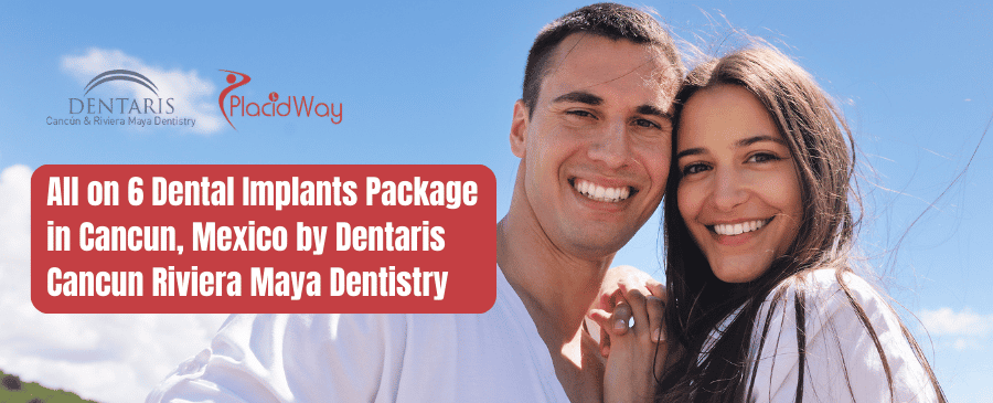 All on 6 Dental Implants Package in Cancun, Mexico by Dentaris Cancun Riviera Maya Dentistry