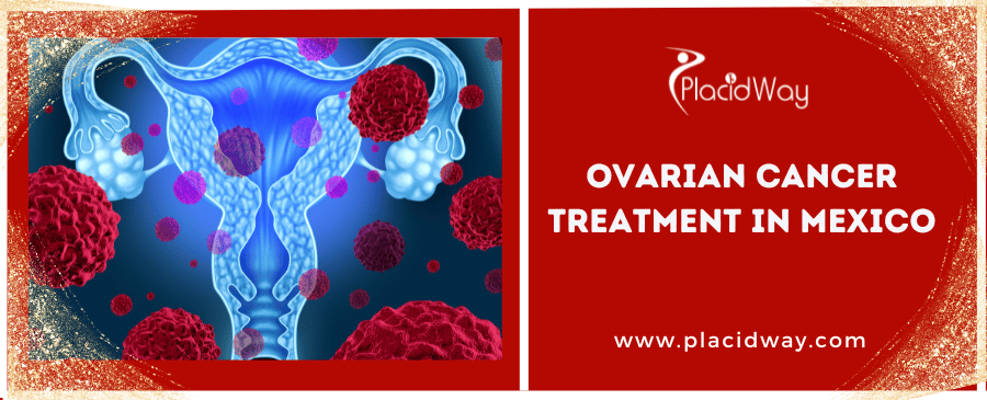 Ovarian Cancer Treatment in Mexico